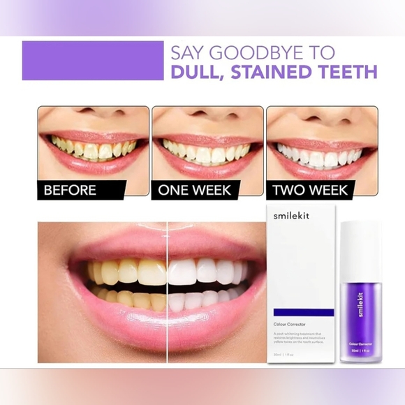 SMILEKIT V34 Color Corrector Teeth Stains Remover - Picture 7 of 9